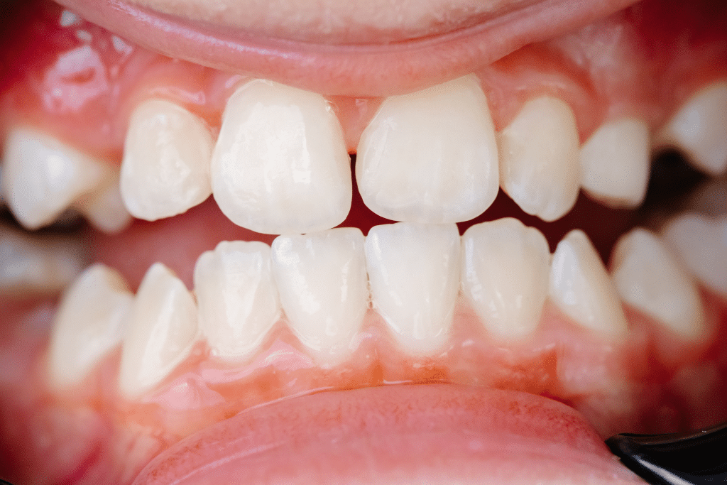orthodontist near me in Layton
