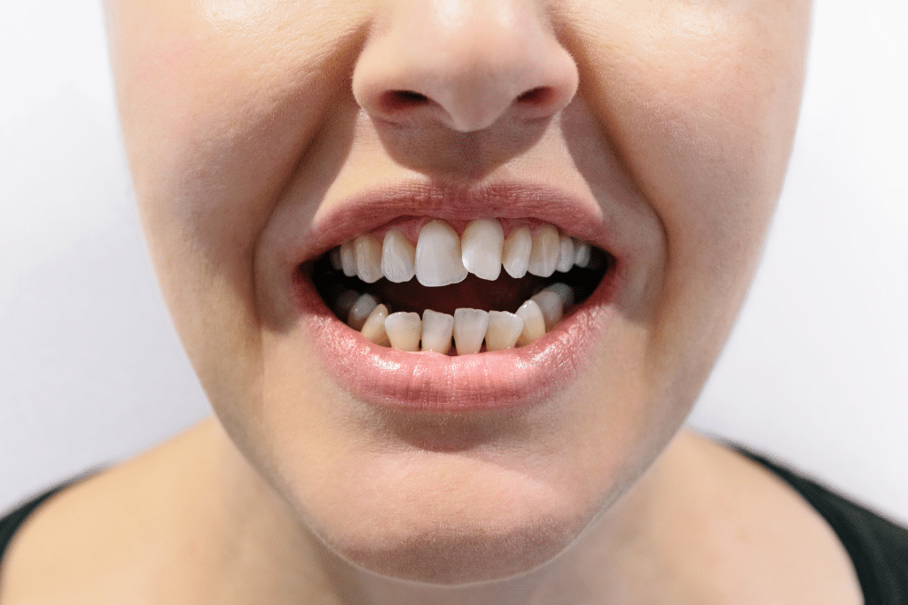 orthodontist in Layton